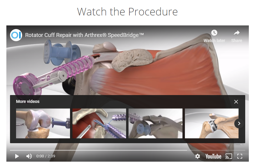 An animated video demonstrates rotator cuff repair surgery using the Arthrex SpeedBridge system, featuring detailed visuals of surgical tools and anatomical structures in the shoulder area.