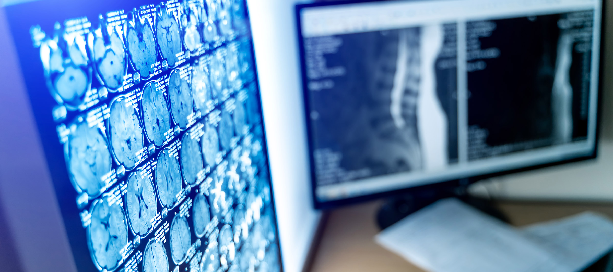 Two computer monitors display medical imaging scans. The left monitor shows multiple MRI images, and the right monitor shows X-ray images. A sheet of paper is placed below the monitors.