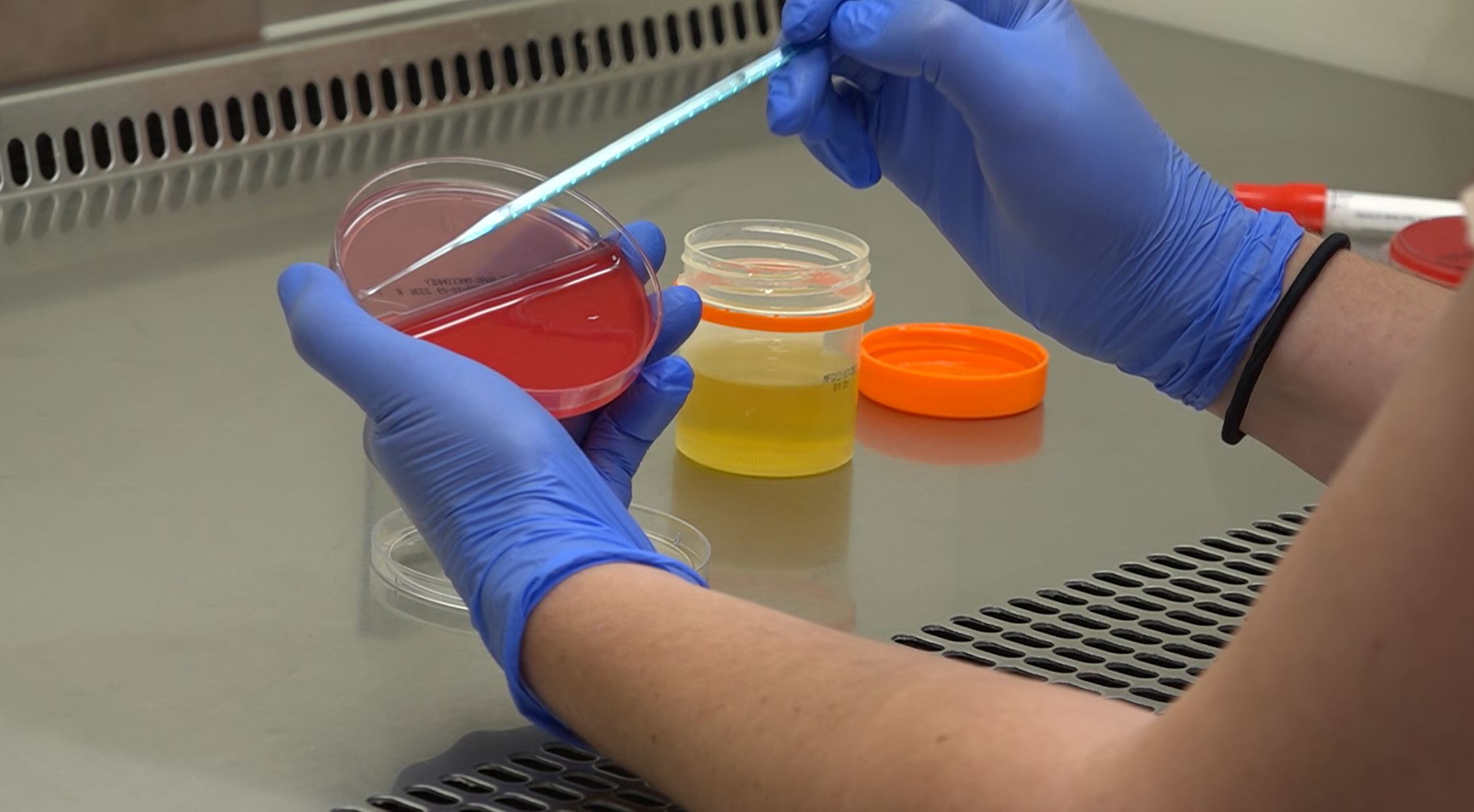 A person wearing blue gloves uses a pipette to transfer liquid into a red agar plate in a laboratory setting.