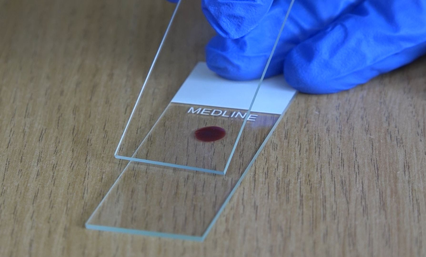 A gloved hand holds a glass slide with a blood sample on it, labeled 