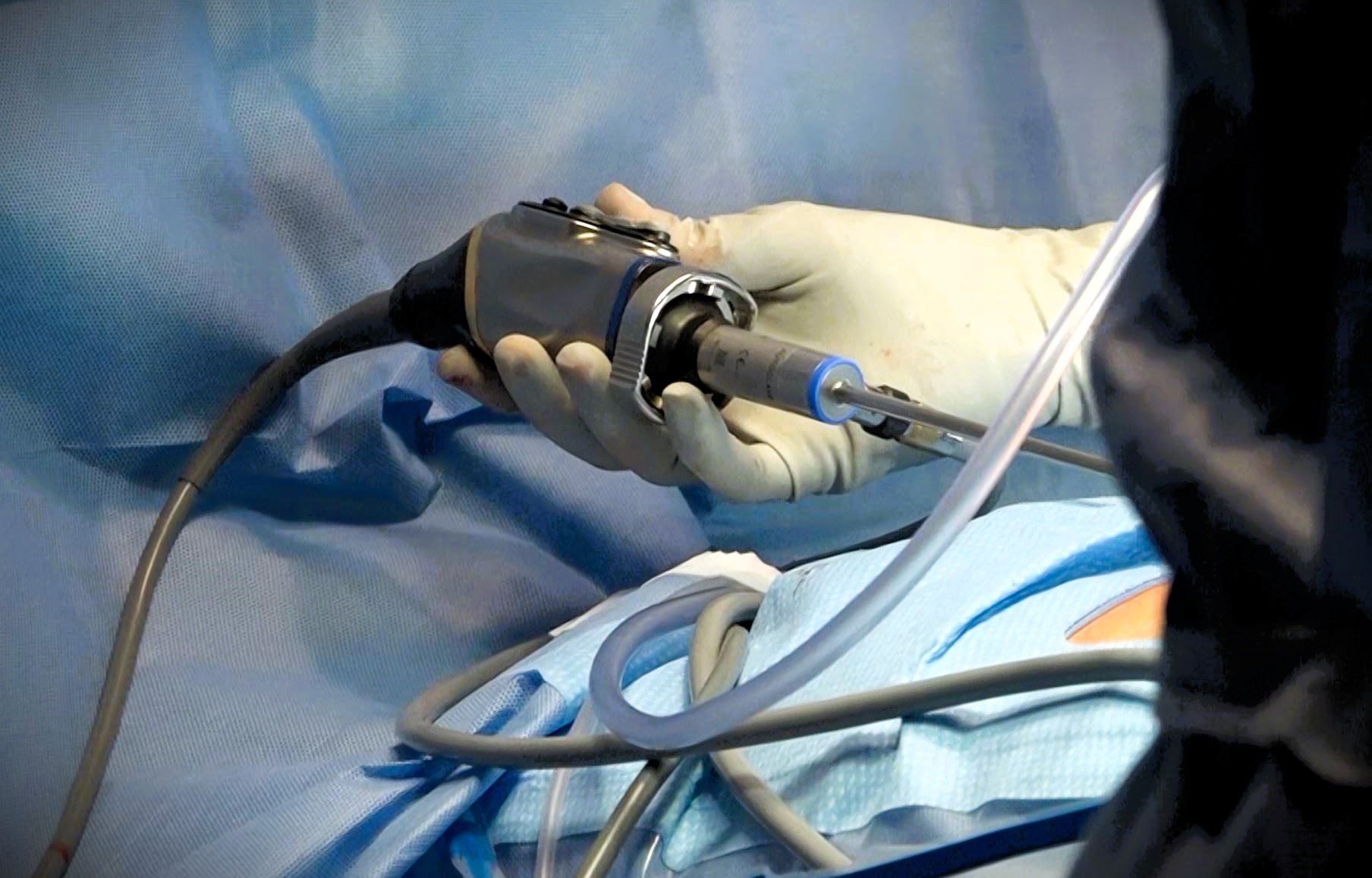 A gloved hand holds a laparoscopic surgical instrument over a patient covered in blue sterile drapes.